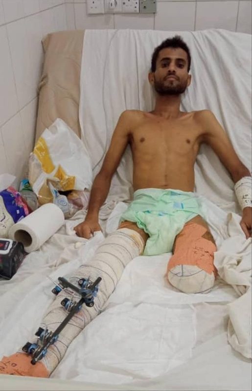 جريح من مليشيا الانتقالي يناشد لإنقاذ حياته وسط إهمال قيادته