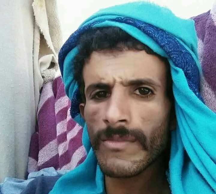 شبوة .. وفاة المواطن علي التومة بعد يومين من إصابته برصاص مسلحين في مدينة عتق
